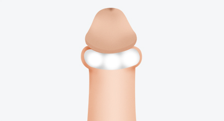 해바라기 링