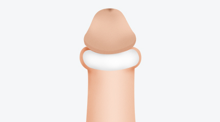베이직 링